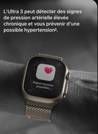 Apple Watch Ultra 3 – 49 mm 2